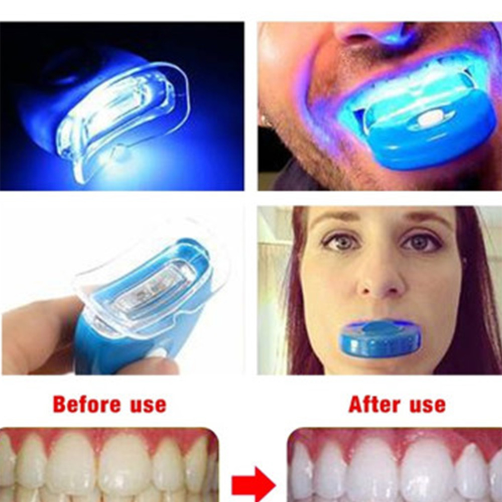 Teeth Whitening Laser Treatment - LED-Zahnaufhellungslicht, Aufhellung, blaues Licht, UV-Licht, Bleichlaser,
