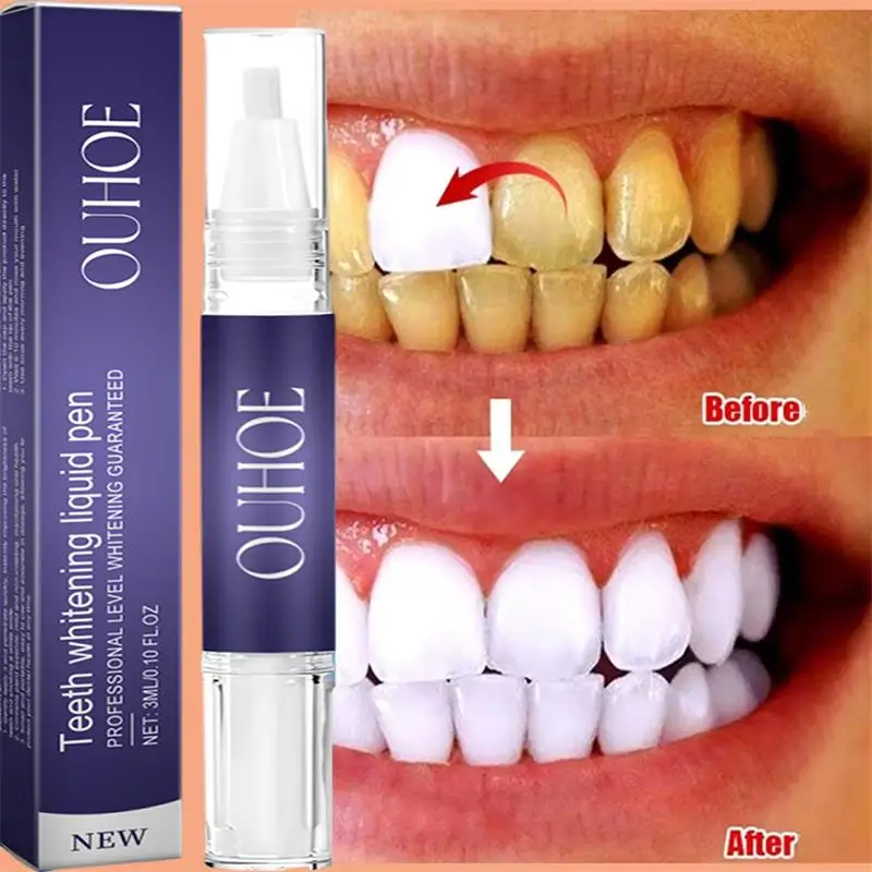 Whitening Pen Bleach - Schnelle Zahnaufhellung Zahnpasta Stift Entfernen Plaque
