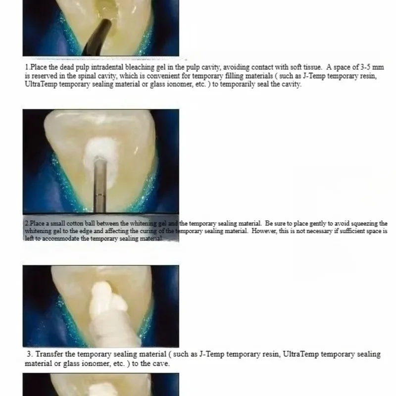 Materialien zur zahnärztlichen – Teeth Whitening Effects Bewertung und Preis