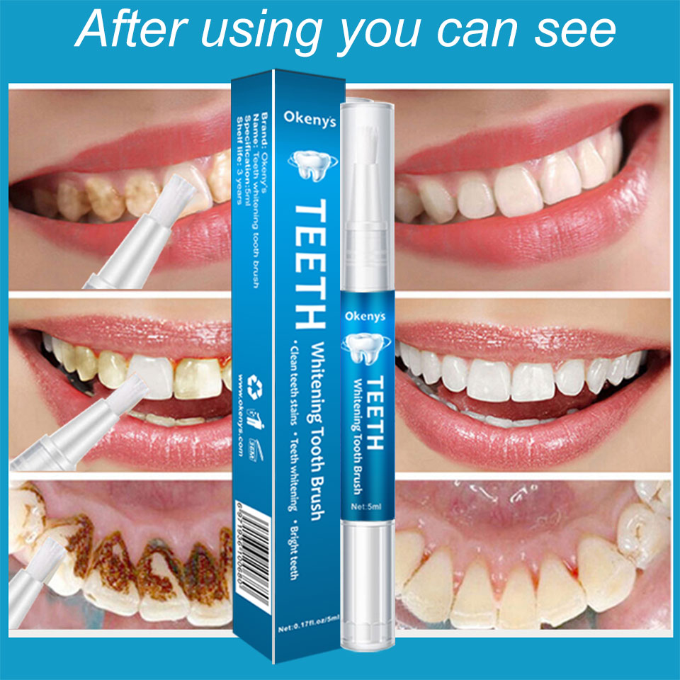 5ml Zähne Bleaching Kit Reinig – Whitening Pen Bleach Bewertung und Preis