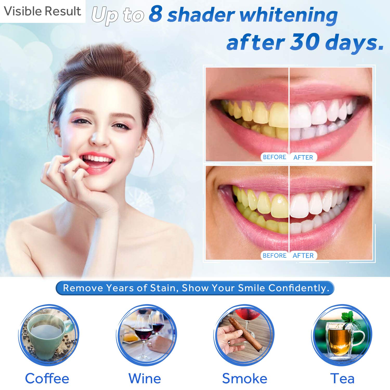 Zahnaufhellungsgel, Nachfüllsp – Teeth Whitening With Trays Bewertung und Preis