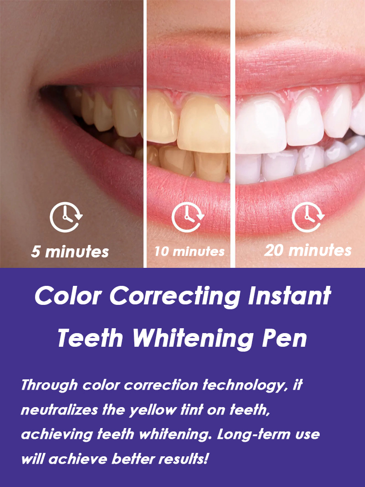 Zahnaufhellungsstift Effektiv  – Whitening Pen Bleach Bewertung und Preis