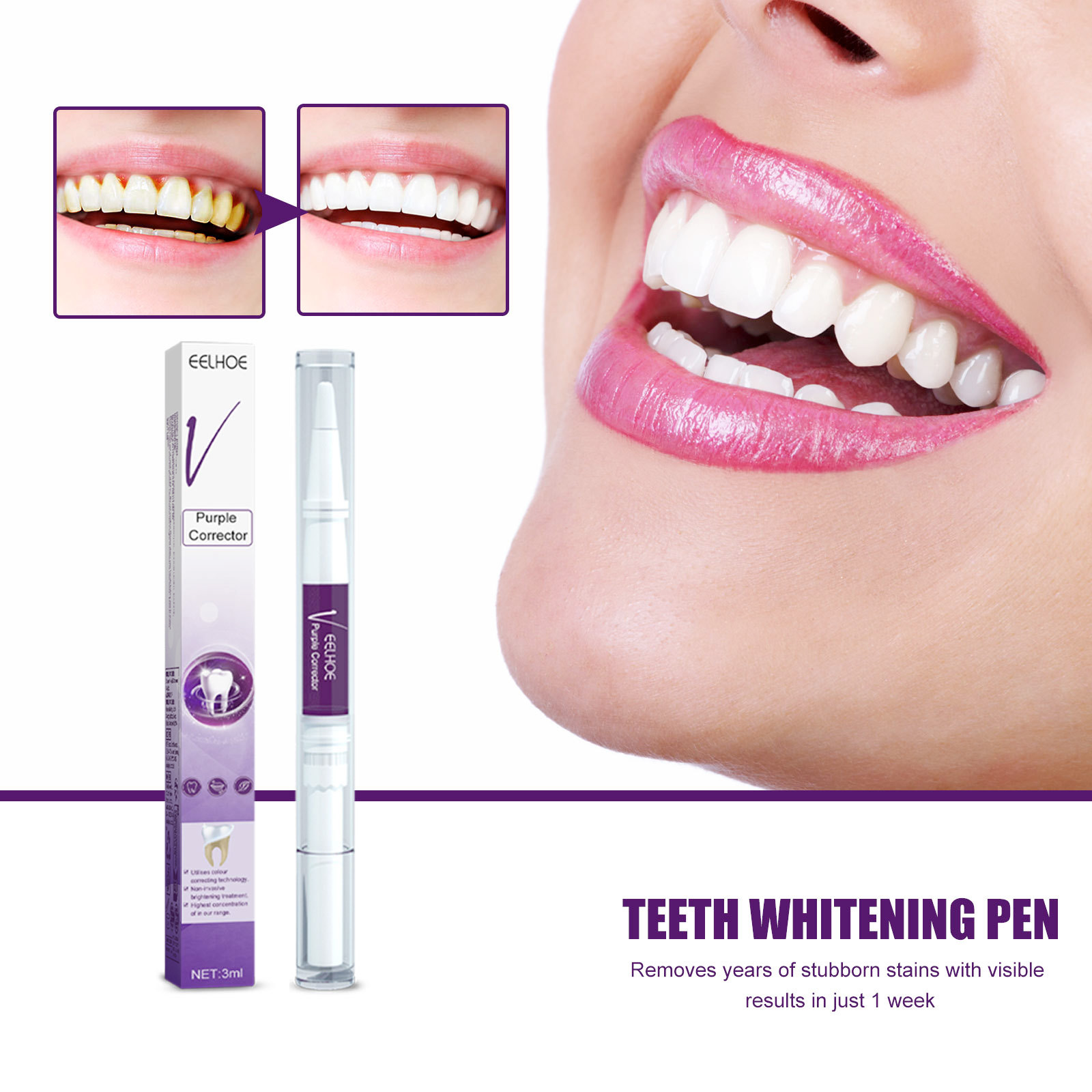 Lila Zähne Bleaching Zahnpasta – Whitening Pen Bleach Bewertung und Preis