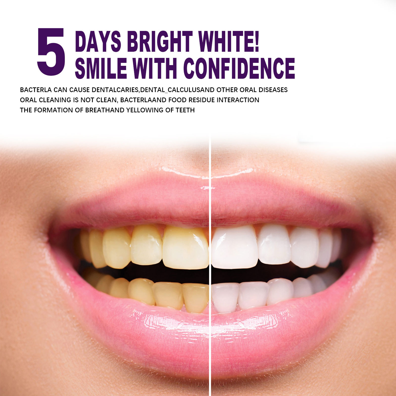 Lila Zähne Bleaching Zahnpasta – Whitening Pen Bleach Bewertung und Preis