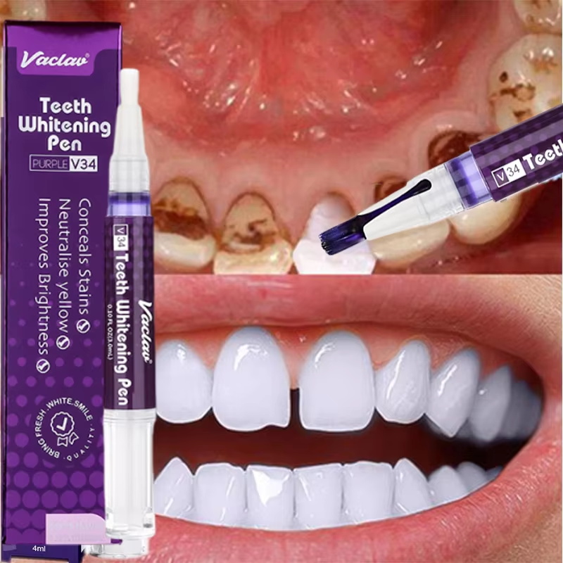 V34 Zahnaufhellungsstift Zahnp – Whitening Pen Bleach Bewertung und Preis